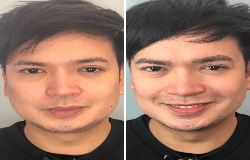 Microblading for Men